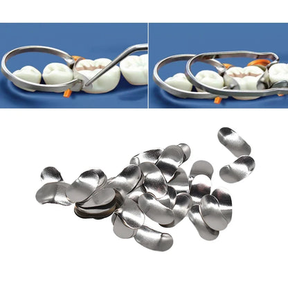 100pcs Dental Sectional Matrix Contoured System Metal Dentistry Resin Clamping Seperating Ring Autoclavable dental