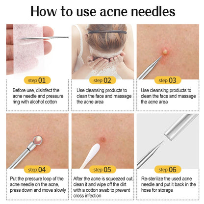 11Pcs/Set Acne Needle Blackhead Clip Remover Extraction Pore Black Head Cleaner Face Skin Care Cleansing Needle Tool Cell Clamp