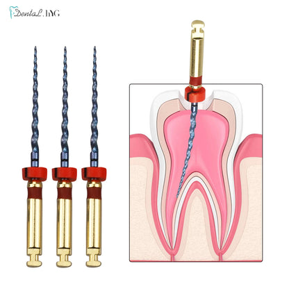 Dental Root Canal File Gold Endo Rotary Super Files Golden Endodontic Files 21mm 25mm Nickel Titainium Instrument Dentistry