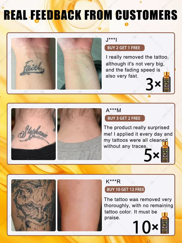 2026 Hot sale For the removal of colored permanent makeup tattoos,pattern tattoo removal