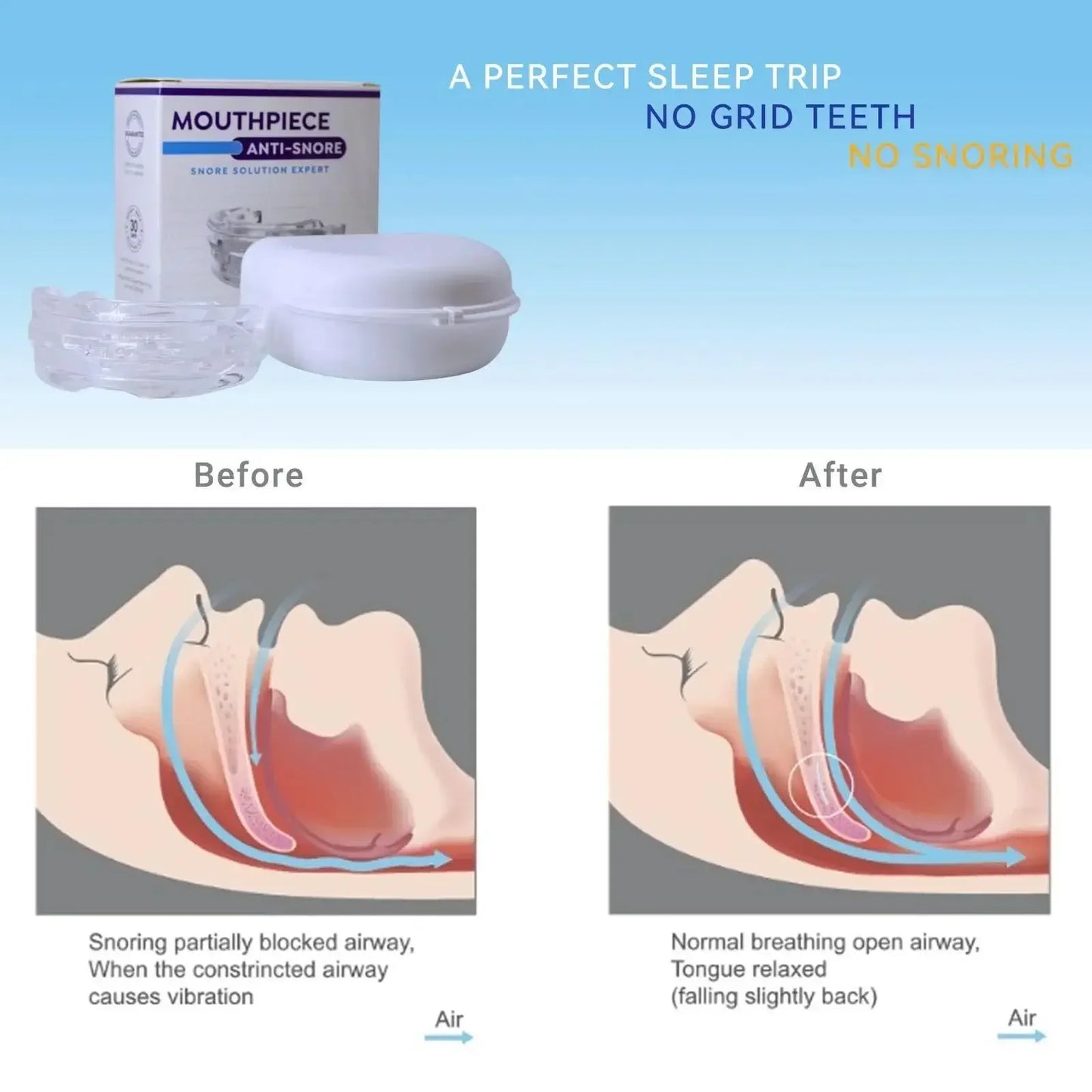 Adjustable Anti-Snoring Mouth Guard Mouthpiece Bruxism Snoring Stopper Sleeping Device Improve Sleep Comfortable Fit